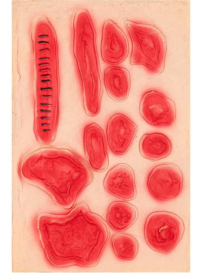 Set heridas infectadas - Funiglobal | Funidelia